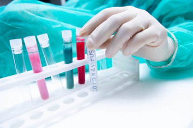 Tıbbi test tüpleri Coronavirus COVID - 2019. Kan testi ve tükürük.