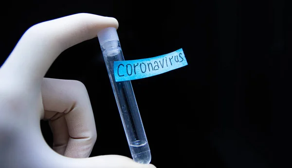 Diagnosekonzept Reagenzglas Coronavirus — Stockfoto