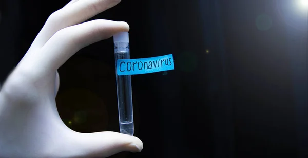 Diagnosekonzept Reagenzglas Coronavirus — Stockfoto