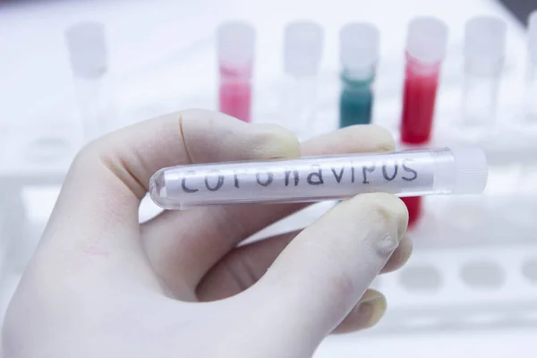 Medizinische Reagenzgläser Testen Coronavirus Covid 2019 Bluttest Und Speichel — Stockfoto