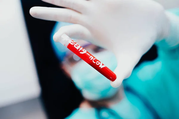 Эпидемический Тест Кровь Врачей Коронавирусной Пробирки Covid 2019 — стоковое фото