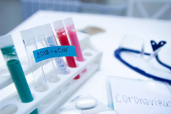 Tıbbi test tüpleri Coronavirus COVID - 2019. Kan testi ve tükürük.