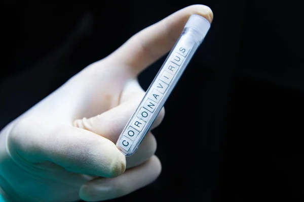 Hand Hand Mit Medizinischem Reagenzglas Mit Positivem Blut Auf Covid19 — Stockfoto
