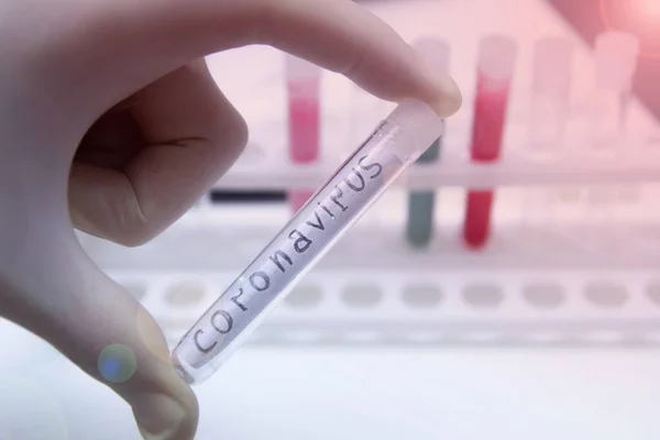 Medical test tubes test coronavirus COVID -2019. Blood test and saliva.