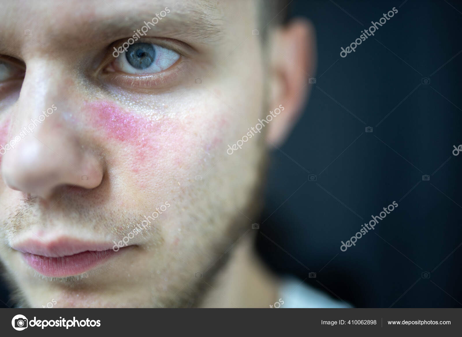 3 754 Age Spots Stock Photos Free Royalty Free Age Spots Images Depositphotos 3 754 Age Spots Stock Photos Free Royalty Free Age Spots Images Depositphotos