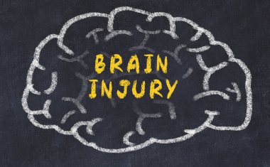 Chalk drawing of human brain with inscription brain injury clipart