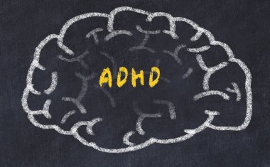 Chalk drawing of human brain with inscription adhd clipart