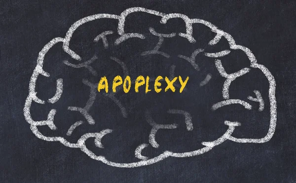 Chalk drawing of human brain with inscription apoplexy