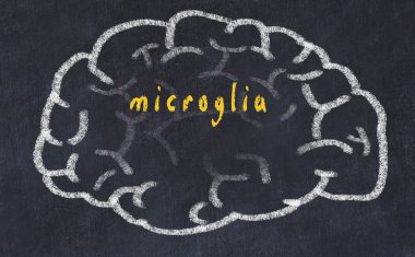Drawind of human brain on chalkboard with inscription microglia clipart
