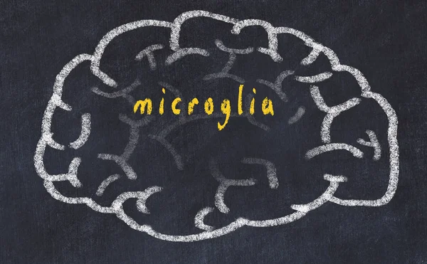 Soffio del cervello umano sulla lavagna con iscrizione microglia — Foto Stock