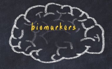 Yazıt biyobelirteçleri ile tebeşir tahtası üzerinde insan beyninin Drawind