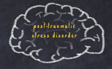 Yazıt post-travmatik stres bozukluğu ile tebeşir üzerinde insan beyninin Drawind