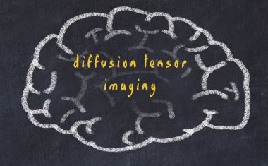 Yazıt difüzyon tensor görüntüleme ile tebeşir tahtası üzerinde insan beyninin Drawind