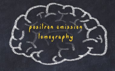 Drawind of human brain on chalkboard with inscription positron emission tomography clipart