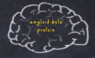 Yazıt amiloid-beta protein ile tebeşir üzerinde insan beyninin Drawind