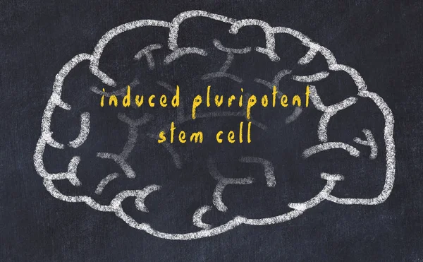 Yazıt indüklenen pluripotent kök hücre ile tebeşir üzerinde insan beyninin Drawind