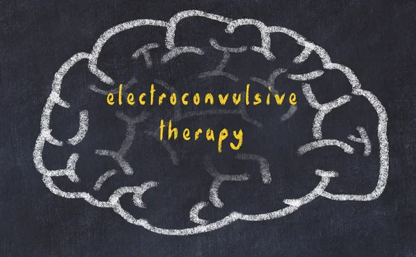 Drawind van menselijk brein op krijtbord met inscriptie elektroconvulsieve therapie — Stockfoto
