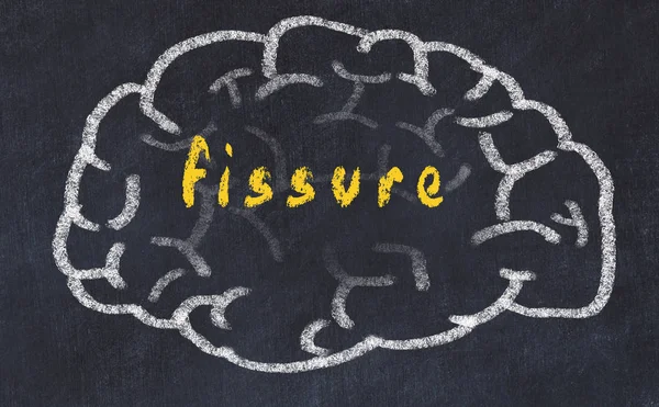 Yazıt fissür ile tebeşir tahtası üzerinde insan beyninin Drawind