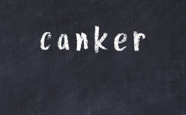 Üzerinde yazı etiketi olan siyah karatahta