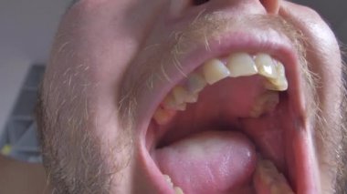 açık ağız kötü dişli, çarpık dişleri mans