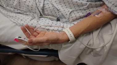Winchester, VA, ABD - 09 03 2025: Olgun bir kadın koluna serum bağlanmış bir şekilde hastanede tedavi görüyor. Çevre sakin ve iyileşme sürecine odaklanmış durumda..