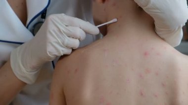 Doktor babys cilt kabarcıklar ve tarafından chickenpox neden döküntü ile krem uygulamak