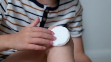 Yaralı küçük çocukların dizine yakın çekim. Yaralı bacağını inceleyen çocuk. Erkek bacağında sıyrıklar