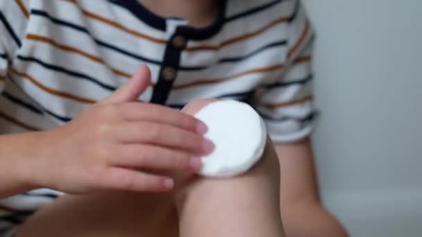 Close-up van geblesseerde jonge kinderen knie. Jongen inspecteerde zijn gewonden geschuurd been. Schaafwonden op de jongens poot — Stockvideo