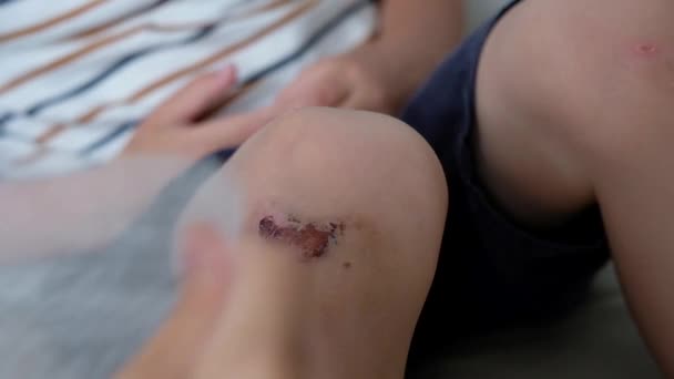 Gros plan de jeunes enfants blessés au genou. Quelqu'un a mis du pansement sur l'abrasion — Video