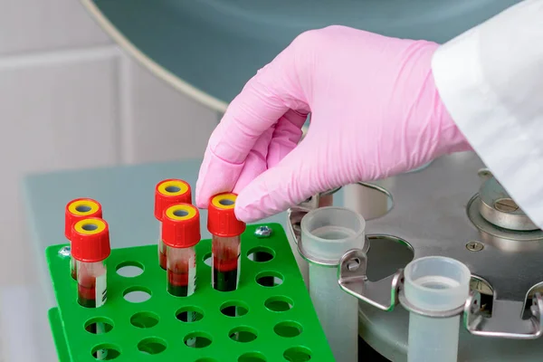 Hand Doctor Taking Test Tube Blood Tray Lab — Stock Photo, Image