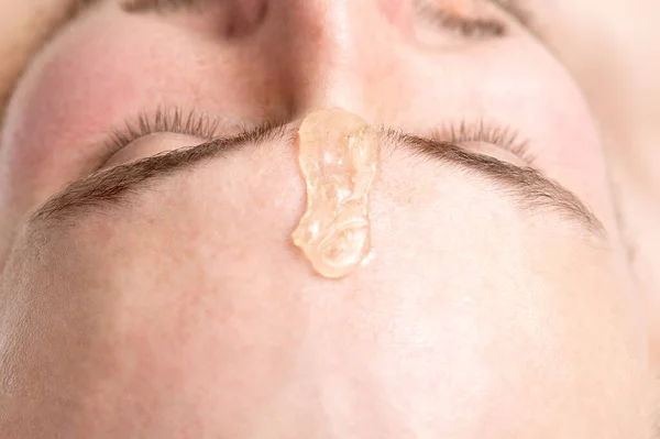 Close up of liquid wax between the eyebrows of a young man before waxing in beauty salon