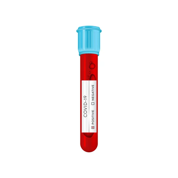 Tube sanguin pour analyse en laboratoire sur le coronavirus SRAS CoV-2. Test sanguin pour la maladie virale Covid-19 NCP. Tube à essai 3d réaliste, échantillon de résultats pour le virus positif-négatif. Illustration vectorielle — Image vectorielle