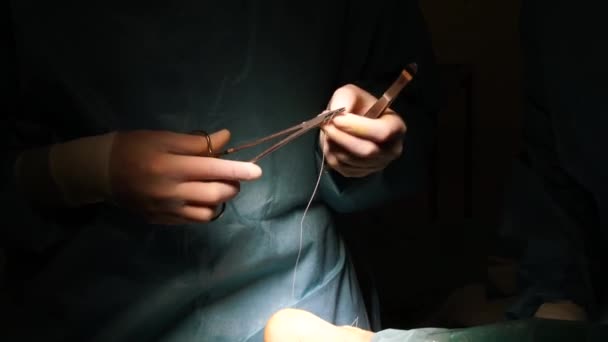 Kirurger Som Opererar Sjukhuset — Stockvideo