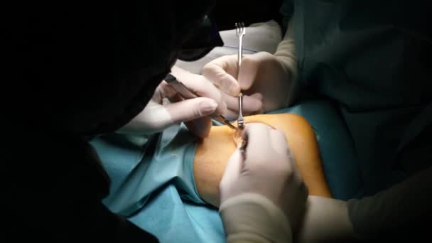 在医院工作的外科医生小组 — 图库视频影像