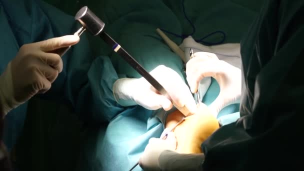 Tým Chirurgů Operujících Nemocnici — Stock video
