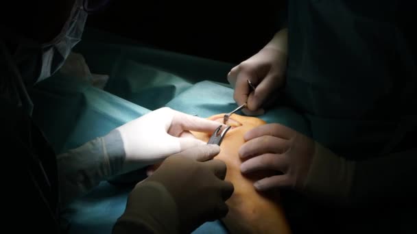 Ομάδα Χειρουργών Που Λειτουργούν Στο Νοσοκομείο — Αρχείο Βίντεο