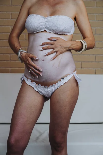 Közelkép a terhes nő hasa krém alkalmazása — Stock Fotó