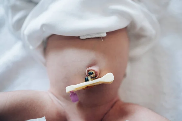 Пуповина, отрезанная от новорожденного — стоковое фото