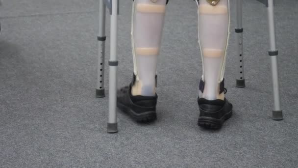Pessoa com deficiência com perna protética — Vídeo de Stock