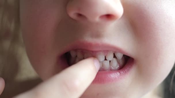 Girl Child Shows First Milk Temporary Tooth — Stock Video