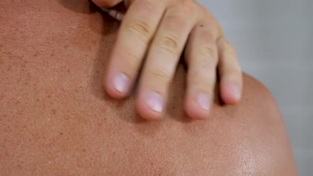 Неопознанный человек касается солнечной кожи с веснушками на плече — стоковое видео