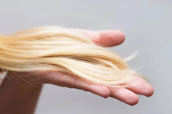 Изображение Женщины Проблемными Волосами Руке — стоковое фото