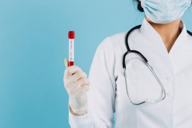 Maskeli bir kadın doktor test tüpleri, kan testleri ve koronavirüs virüsü taşıyabilir. covid-19 kavramı