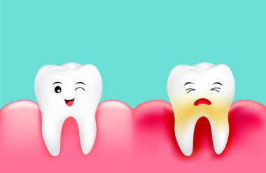 Dental plak ile inflamasyon ve sağlıklı diş. Sevimli çizgi tasarım, illüstrasyon izole yeşil arka plan üzerinde. Diş Bakımı kavramı.