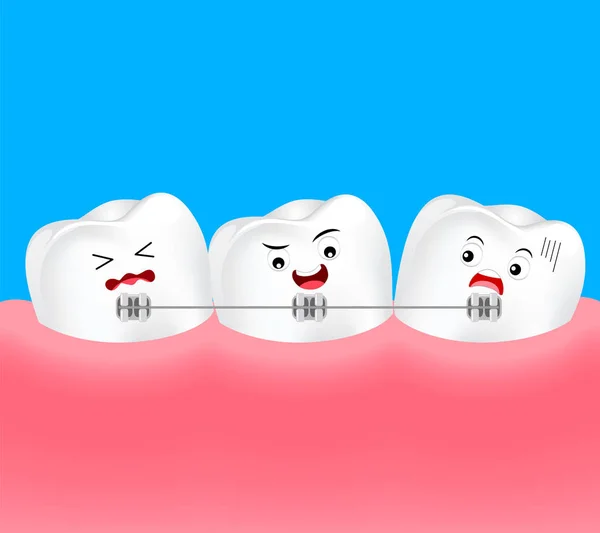 Cute Cartoon Teeth Braces Dental Care Concept Illustration — Stock Vector