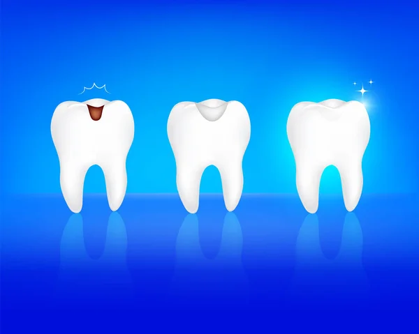 Βήμα Δοντιού Πλήρωσης Φθορά Των Δοντιών Κατάργηση Αποσύνθεση Και Λευκό — Διανυσματικό Αρχείο