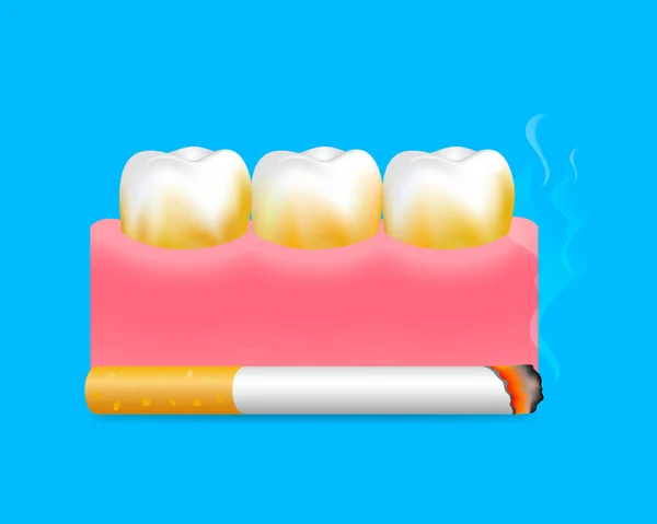 Dientes Con Cigarrillo Efecto Fumar Dientes Humanos Concepto Cuidado Dental — Archivo Imágenes Vectoriales