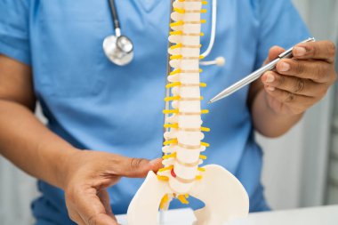 Omurga ve kemik modeli taşıyan Asyalı doktor, ortopedi bölümünde tedavi için bel kemiği yerinden oynamış disk parçası..