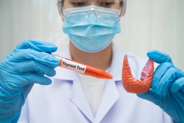 Doktor tiroid bezi modeli ve kan örneği tüpünü laboratuarda tutuyor..