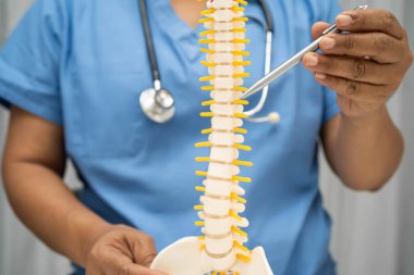 Omurga ve kemik modeli taşıyan Asyalı doktor, ortopedi bölümünde tedavi için bel kemiği yerinden oynamış disk parçası..